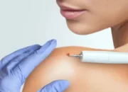 Membasmi kutil yang menempel ke kulit tubuh kita.