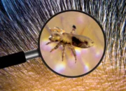 menghilangkan kutu anak pada rambut.